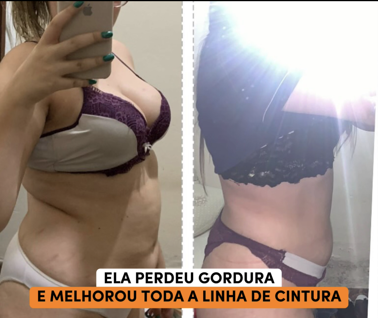 Foto antes e depois ceci